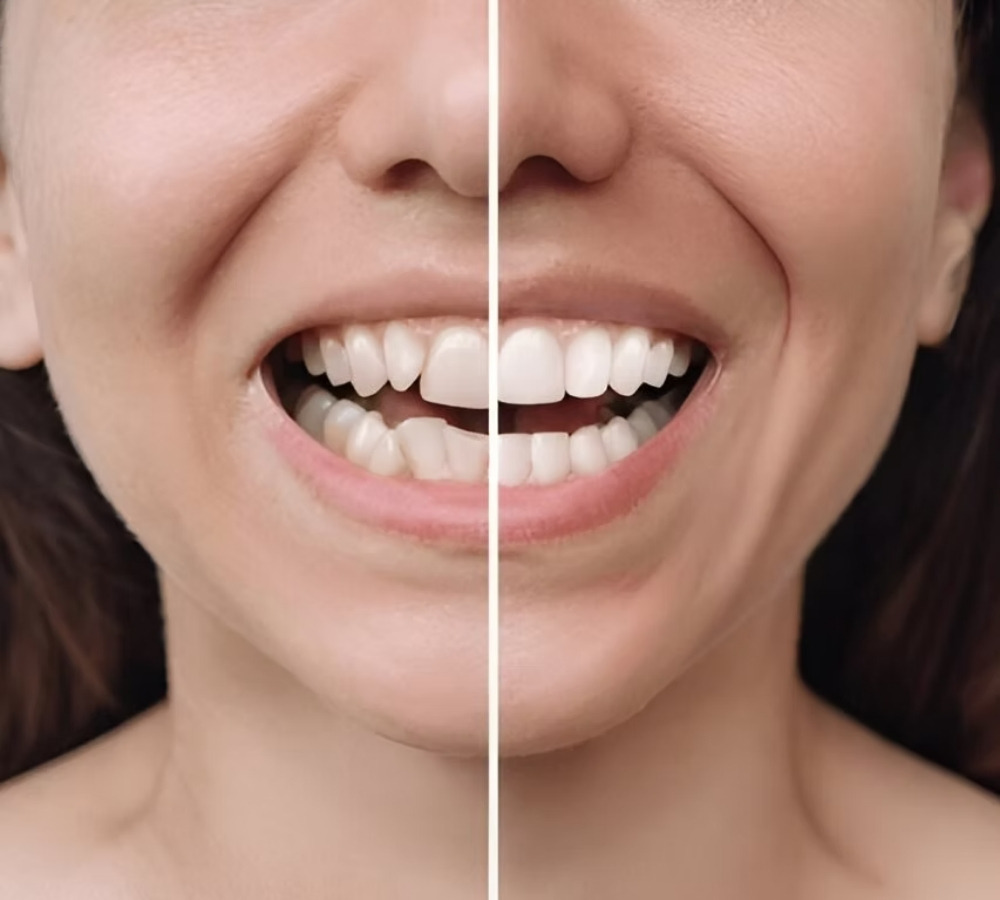 cosmetic dentistry edmonton