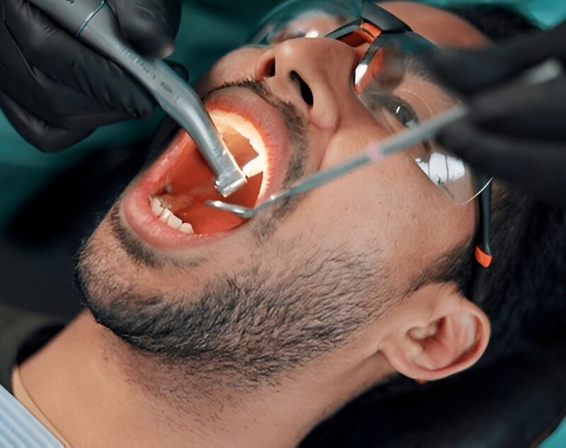 Tooth Extraction Edmonton