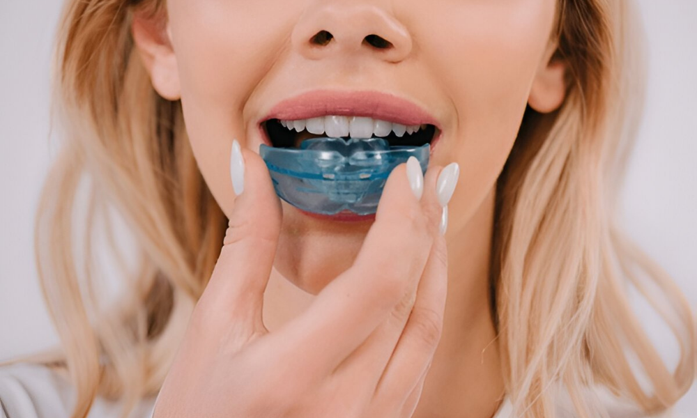 Bruxism Night Guard Edmonton